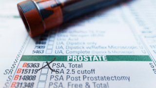 Prostate Exam