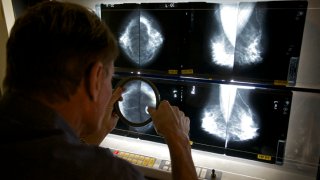 Mammograms Cuts