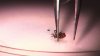 Concerns About Rising Rates of Tick-Borne Illness in Maine