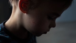 A side profile of a child's face looking downward as a shadow obscures his eyes.