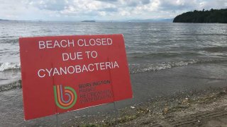 A sign closing a Lake Champlain beach in Vermont because of a cyanobacteria bloom