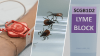 MIT scientists want to create a ‘Lyme Block' with proteins found in your sweat